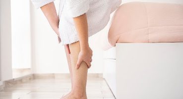 Yazın varis tedavisi olur mu?