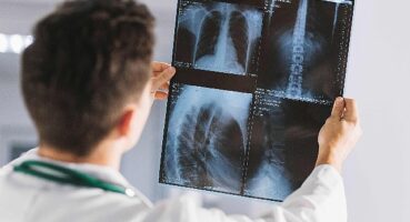 “Dr. Türktemiz; İyonlaştırıcı Radyasyonun Olumsuz Etkilerini Azaltmak Mümkün"