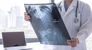 Kanser Önlenebilir Bir Hastalıktır!