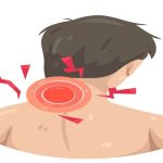 Boyun Fıtığı ve Evde Uygulanabilecek Tedavi Yöntemleri: Kupa Masajı mı, Kas Gevşetme mi?