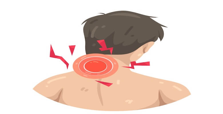 Boyun Fıtığı ve Evde Uygulanabilecek Tedavi Yöntemleri: Kupa Masajı mı, Kas Gevşetme mi?
