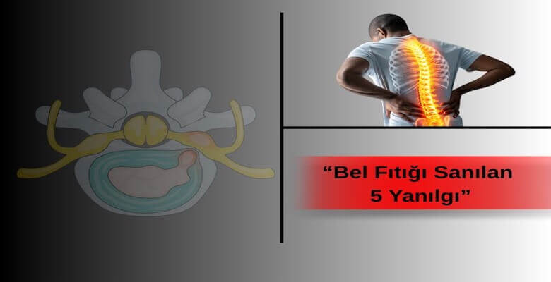 Bel Fıtığı Sanılan 5 Yanılgı